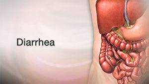 sehatnagar-vomiting-and-chronic-diarrhea-tips-for-healthy-living-lifestyle