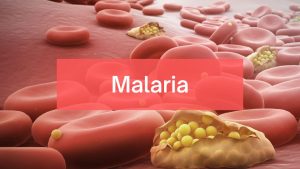 malaria-high-fever-causes-symptoms-risk-factors