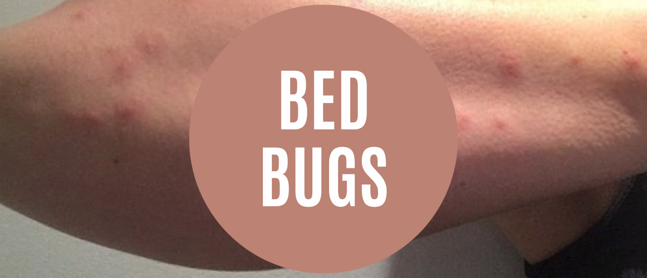 sehatnagar-bed-bug-bites-tips-for-healthy-living-lifestyle