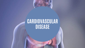 sehatnagar-cardiovascular disease-tips-for-healthy-living-lifestyle