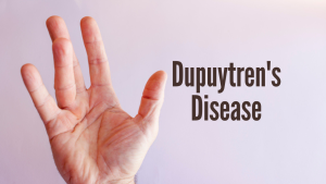 sehatnagar-Dupuytren's-disease-tips-for-healthy-living-lifestyle