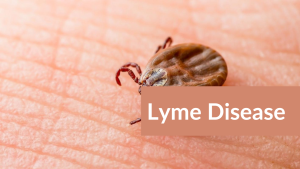 sehatnagar-lyme-disease-rash-tips-for-healhty-living-lifestyle