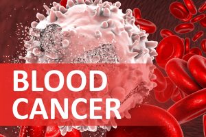 Blood-cancer-sehatnagar-com