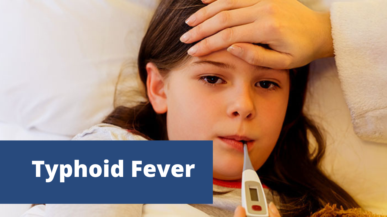 What Is Typhoid Fever And How To Prevent From Typhoid?