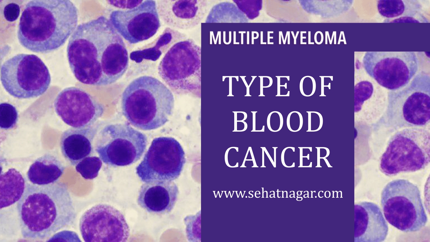 Multiple-Myeloma-Type-of-blood-cancer