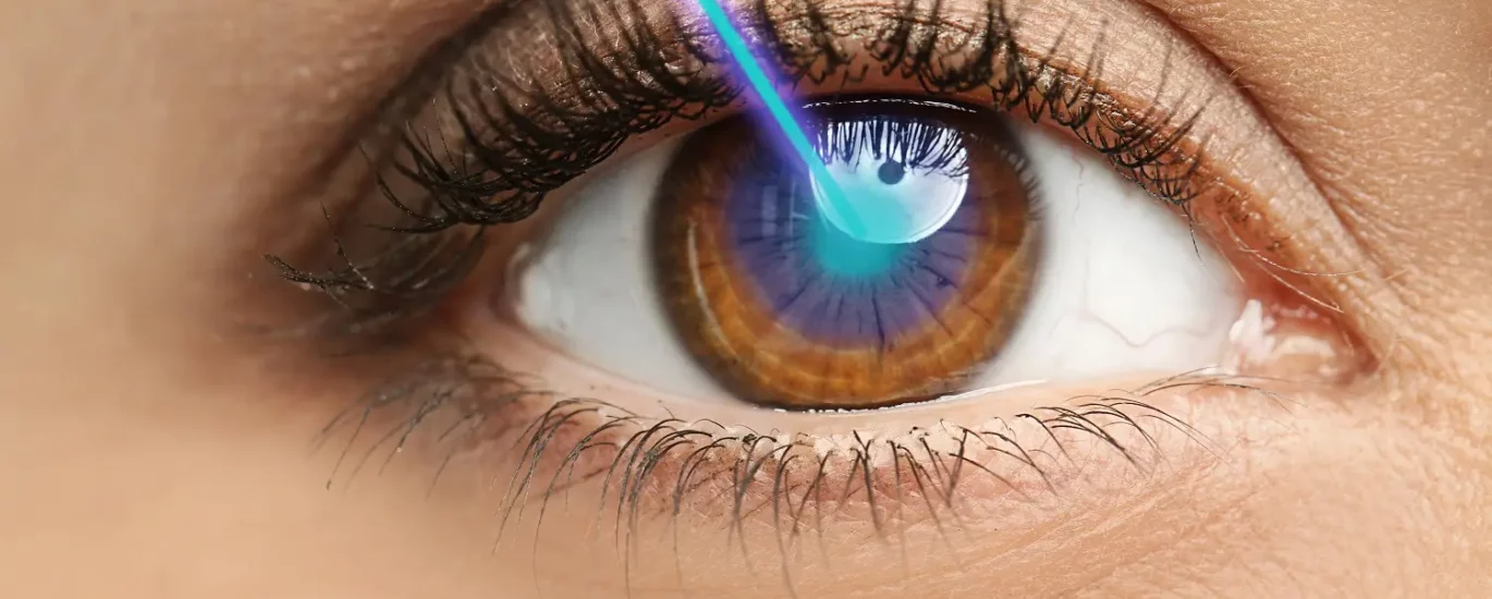 laser-eye-surgery-sehatnagar-com
