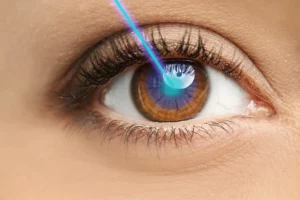 laser-eye-surgery-sehatnagar-com