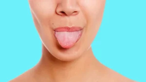 tongue-health-chart-sehatnagar-com