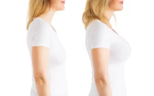 fat-transfer-breast-augmentation-sehatnagar-com