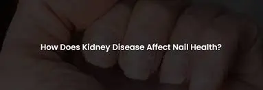 kidney disease nails